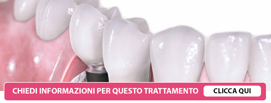 capsule-ceramica-lissone