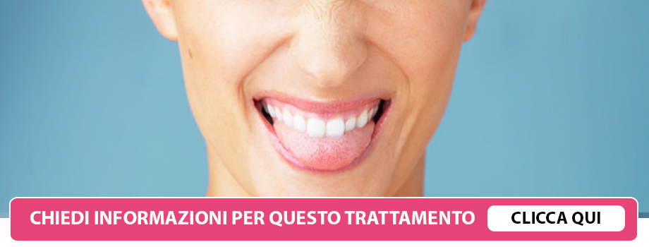 cura-alitosi-lissone