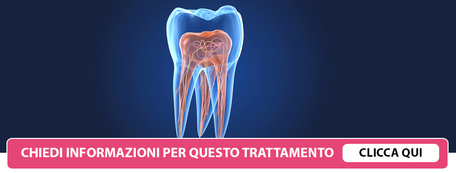 endodonzia a Lissone