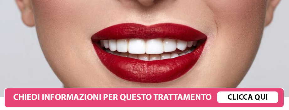 estetica-dentale