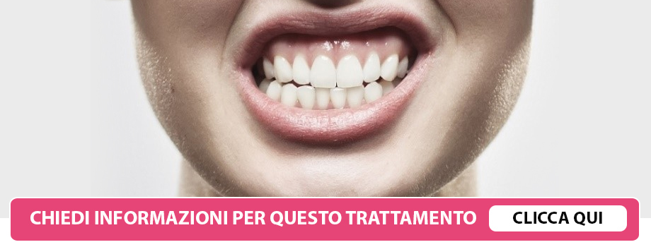 gnatologia-lissone