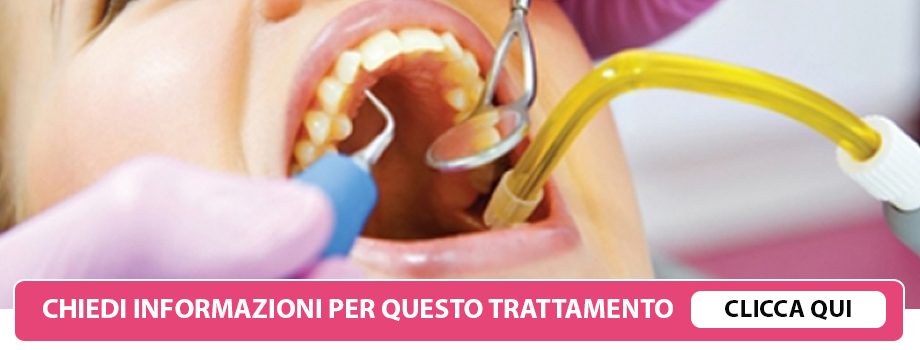 igiene-dentale-lissone