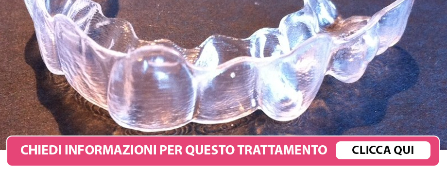 invisalign-lissone