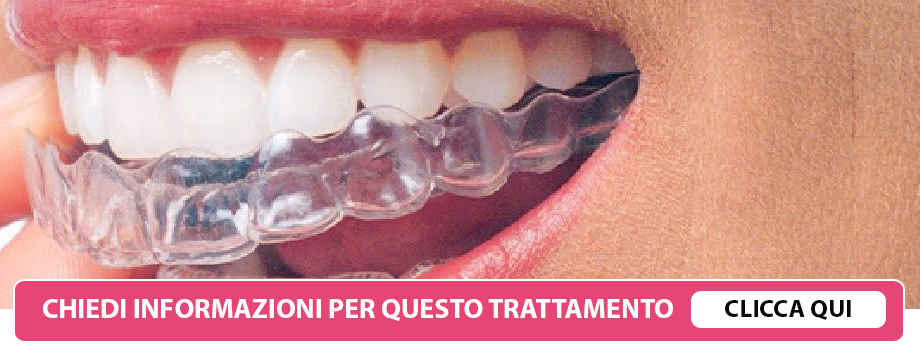 invisalign-ortodonzia-lissone
