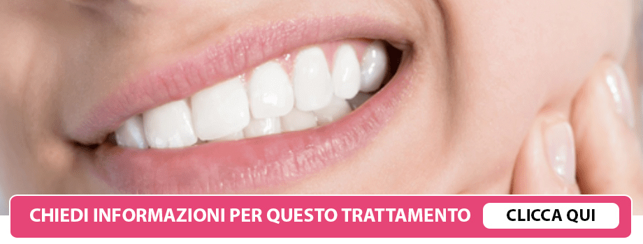 malloclusione-dentale-lissone