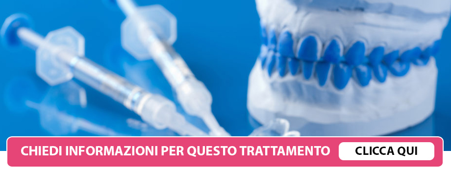 Sbiancamento Professionale a Lissone - Dentista Lissone - Studio Dentistico  Ruzza